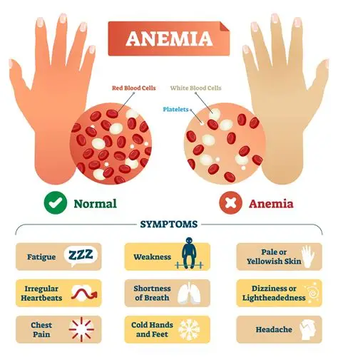 Anemia: Penyebab, Gejala, Dampak, dan Cara Pencegahannya